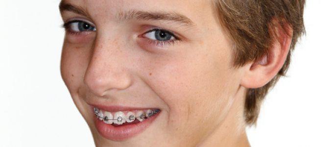 Zahnarzt Selters Kieferorthopädie Kinder