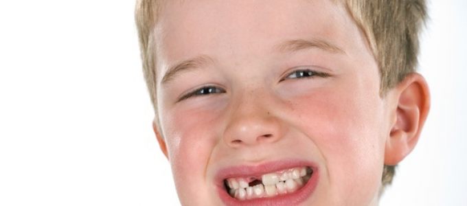 Zahnarzt Selters Zahnlücke bei Jungen